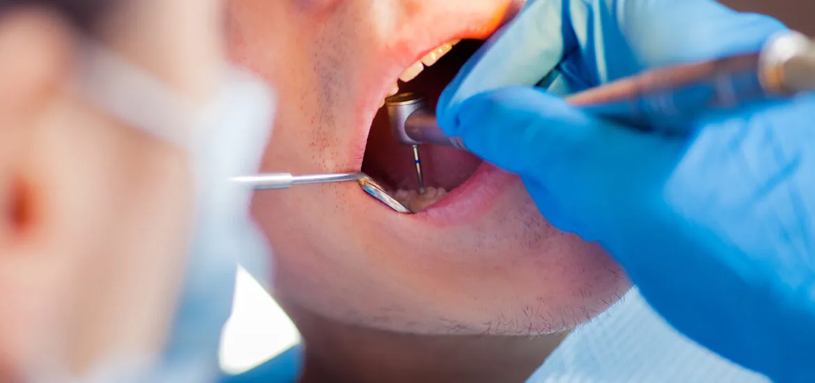 doctor inspecting a infected tooth in need of extraction